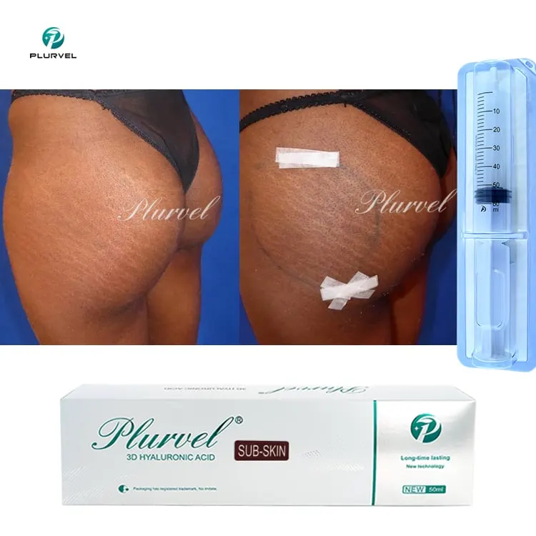 Medical Body Filler 50cc — Body HA